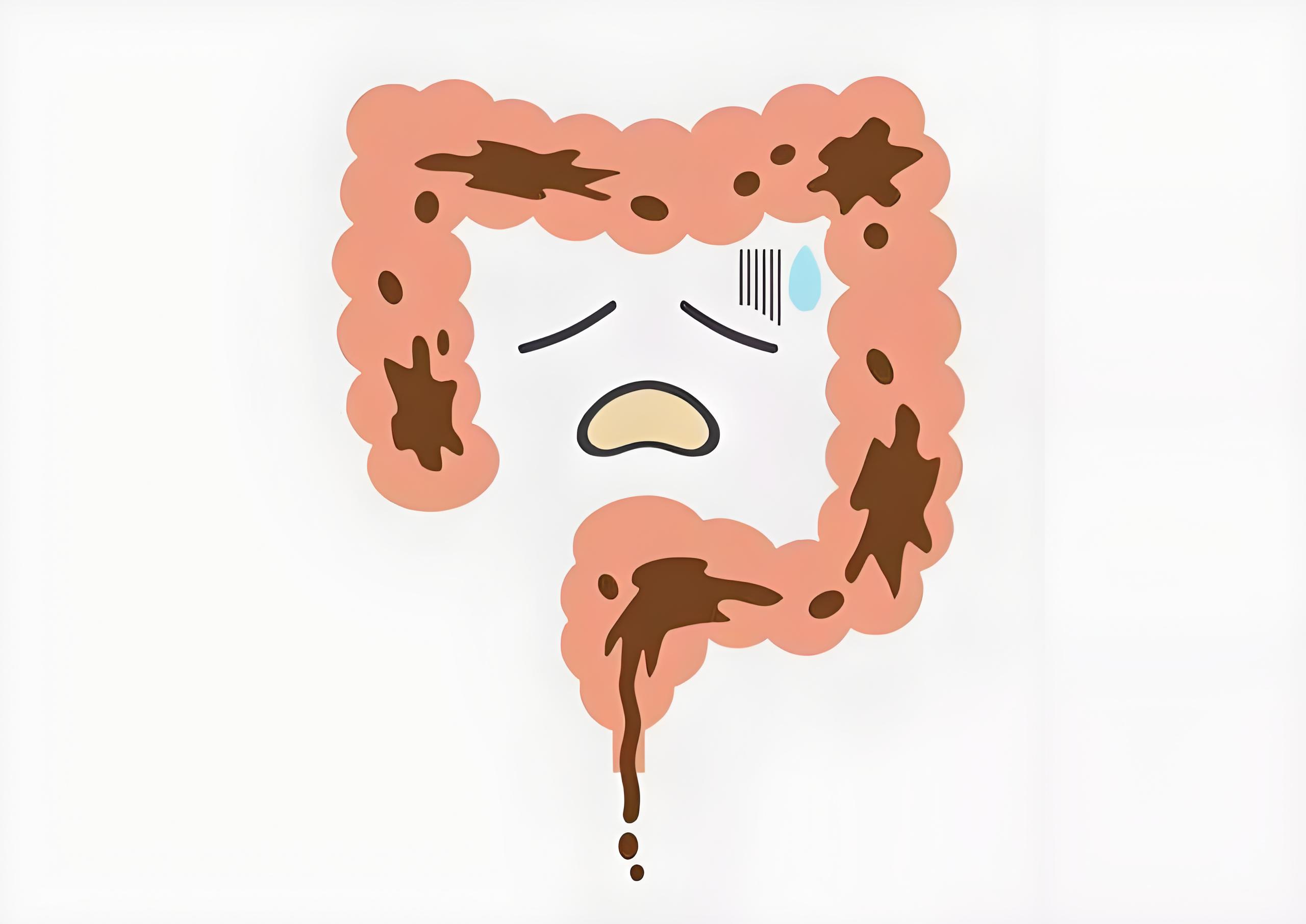生活中如何预防肠易激综合征的发生？(图2)
